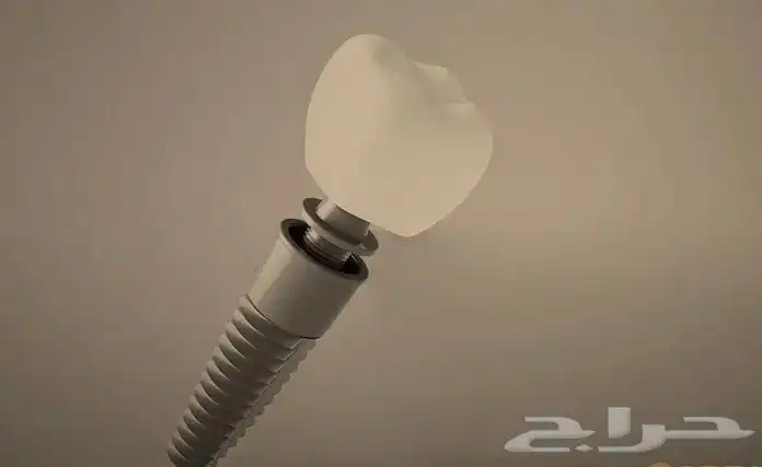 زرعات أسنان 3