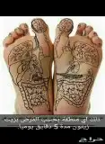الدسك الشلل الجزئي الغيبوبة 2