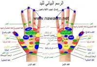 الدسك الشلل الجزئي الغيبوبة 1