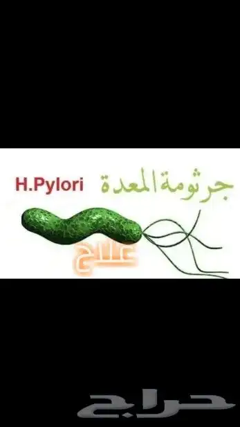 الدسك الشلل الجزئي الغيبوبة 0
