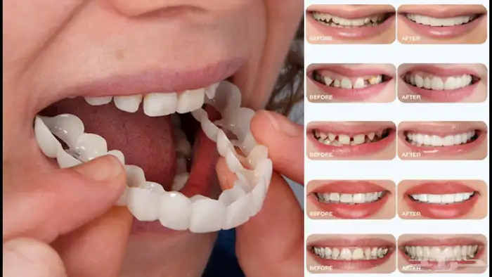 هوليود سمايل 11