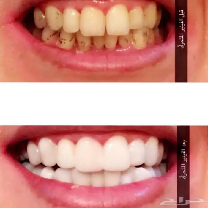 هوليود سمايل 11