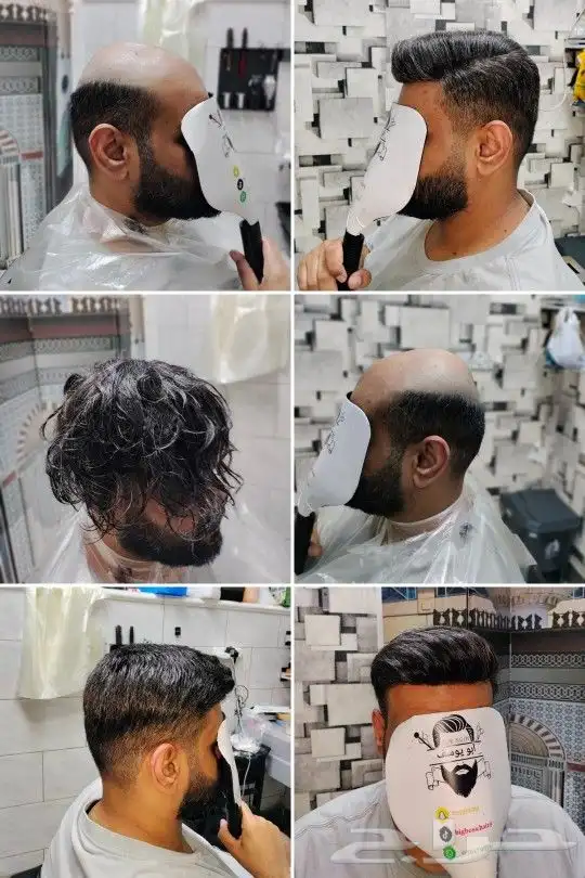 ابو يوسف مختص تركيب شعر طبيعي 1