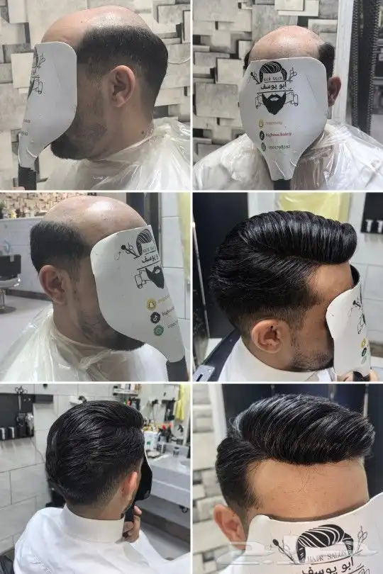 ابو يوسف مختص تركيب شعر طبيعي 0