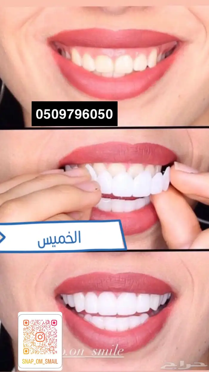 هوليود سمايل 0