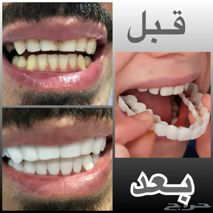 هوليود سمايل 6