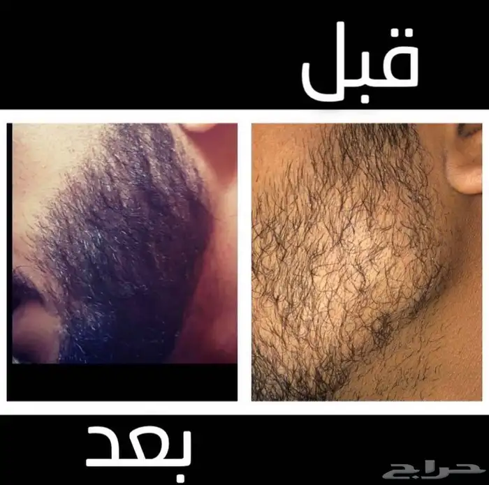 ىزيت ينبت ويكثف الشعر 0
