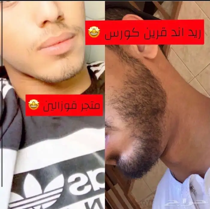 ىزيت ينبت ويكثف الشعر 3