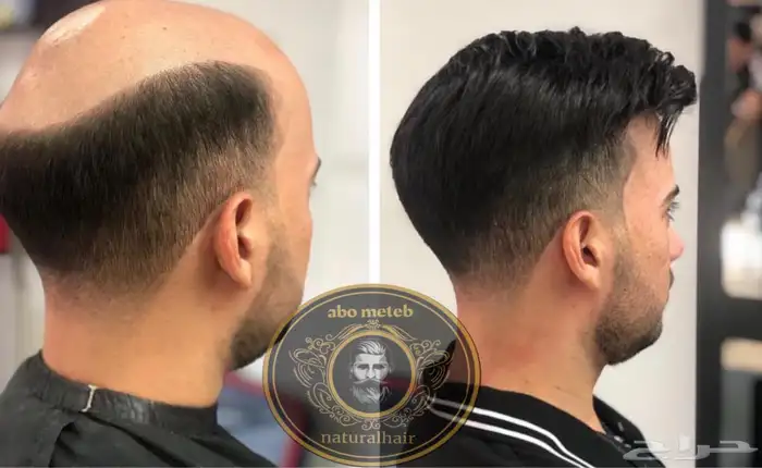 باروكة شعر طبيعي رجالي 6