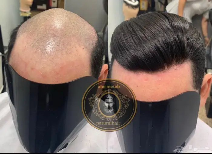 باروكة شعر طبيعي رجالي 0