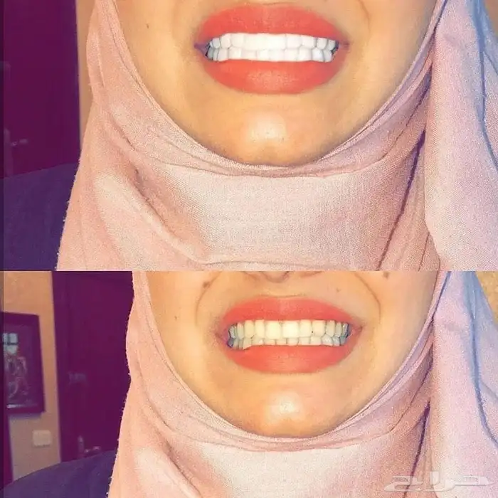 ابتسامتك علينا 10