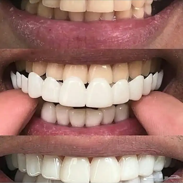 ابتسامتك علينا 2