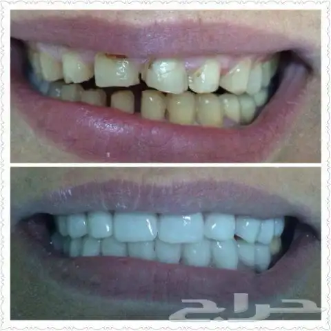 ابتسامتك علينا 5