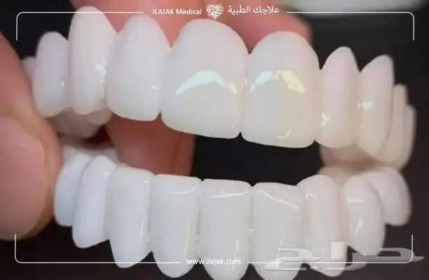 ابتسامتك علينا 1