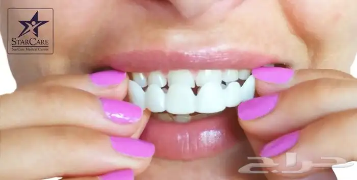 ابتسامتك علينا 11