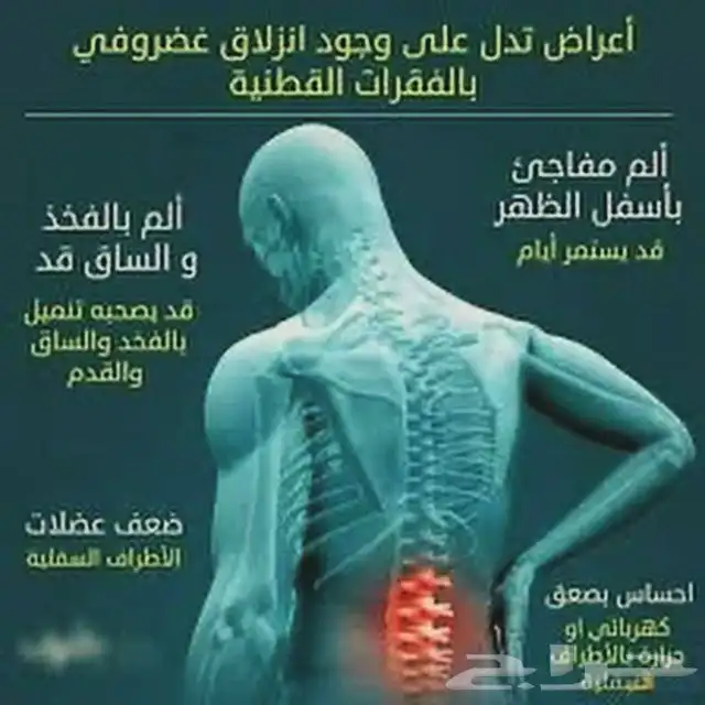 معالج شعبي لي علاج عرق النساء والابهر والانزلاق الغظروفي 0