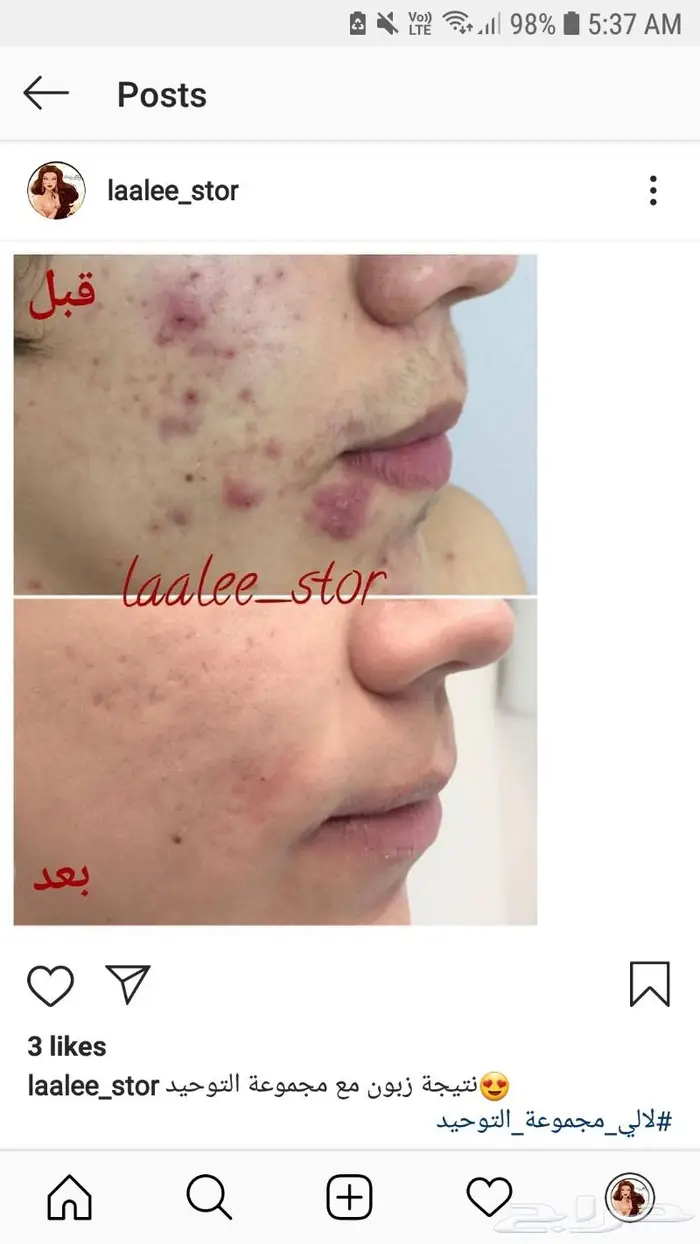 للرجال والنساء 31