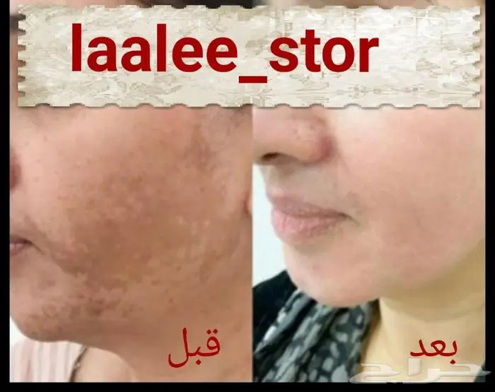 للرجال والنساء 19