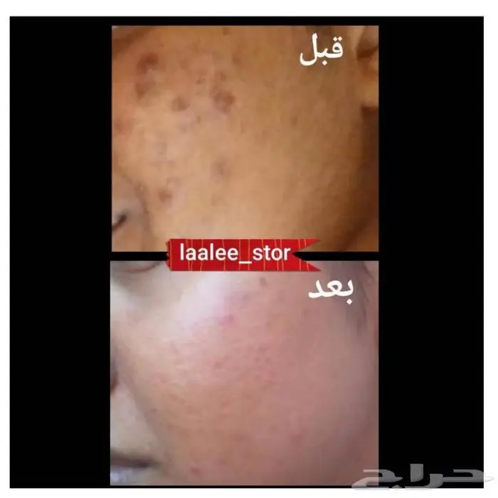 للرجال والنساء 1