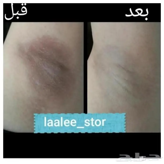 للرجال والنساء 3