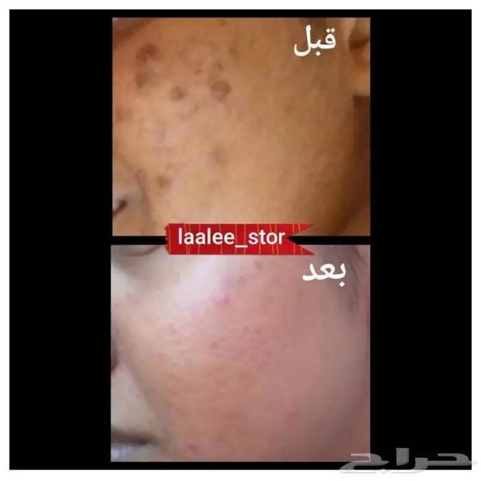 للرجال والنساء 4