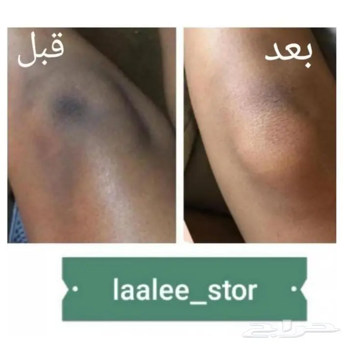 للرجال والنساء 7