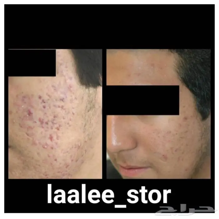 للرجال والنساء 5
