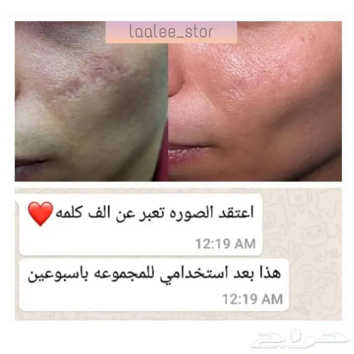 للرجال والنساء 8
