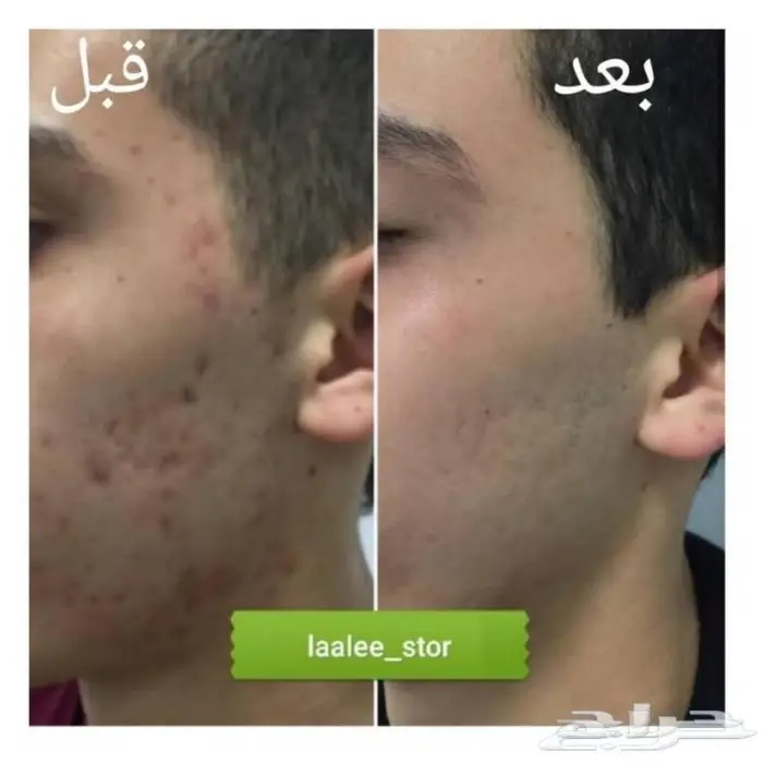 للرجال والنساء 10