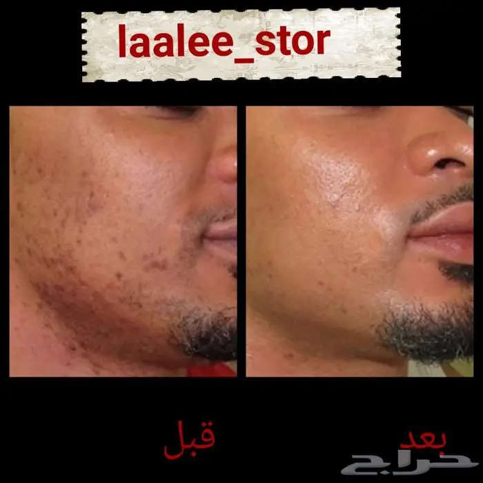 للرجال والنساء 11