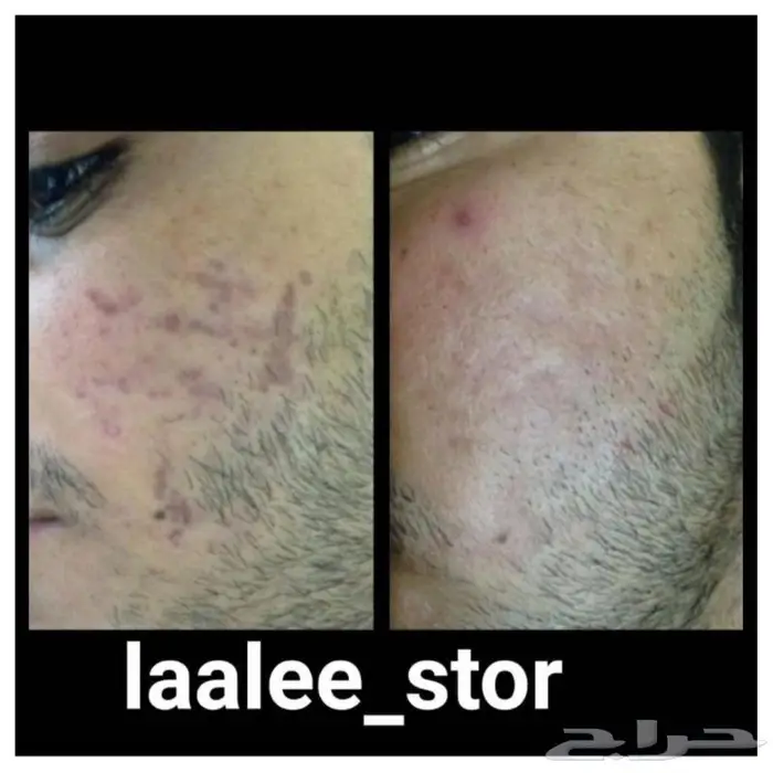 للرجال والنساء 14