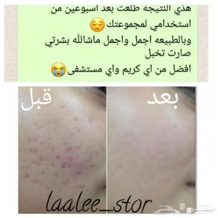 للرجال والنساء 15
