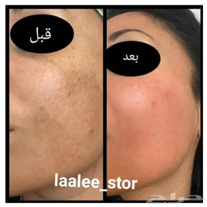 للرجال والنساء 16