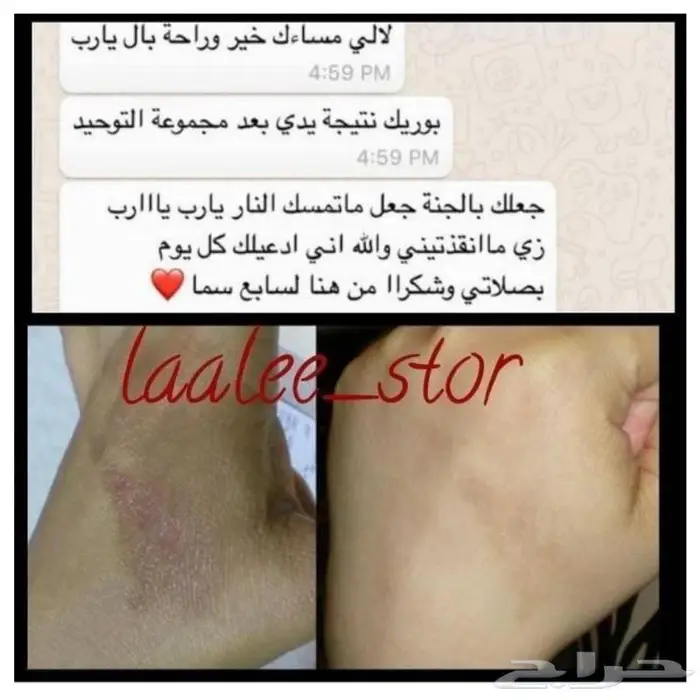 للرجال والنساء 18