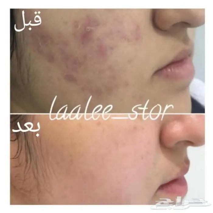 للرجال والنساء 20