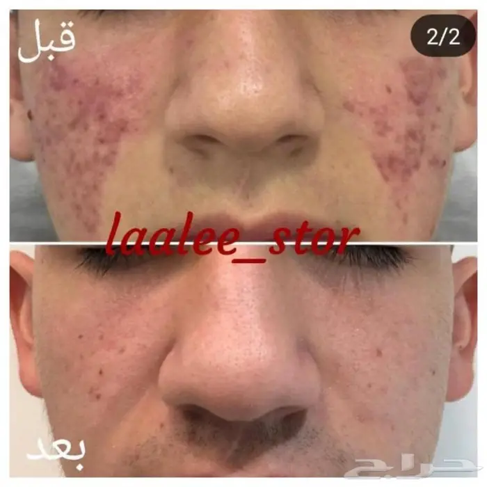 للرجال والنساء 22