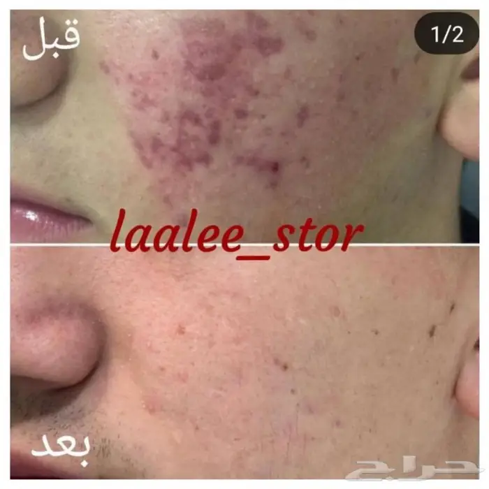 للرجال والنساء 24