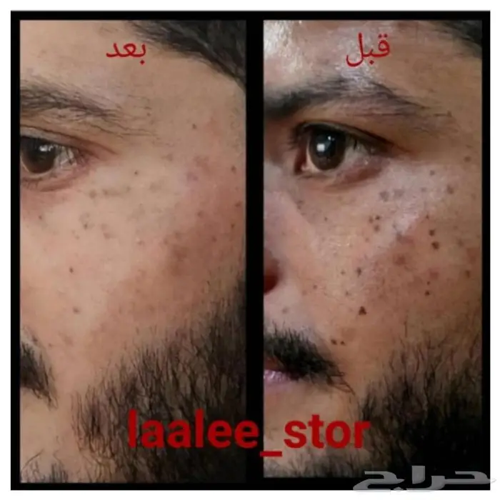 للرجال والنساء 27