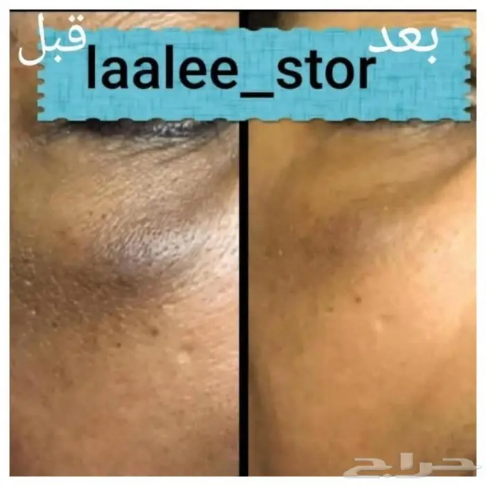 للرجال والنساء 28