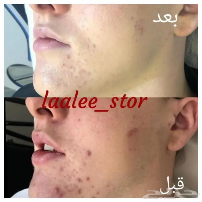 للرجال والنساء 29