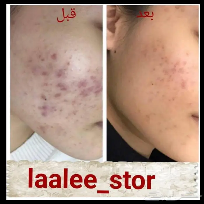 للرجال والنساء 30
