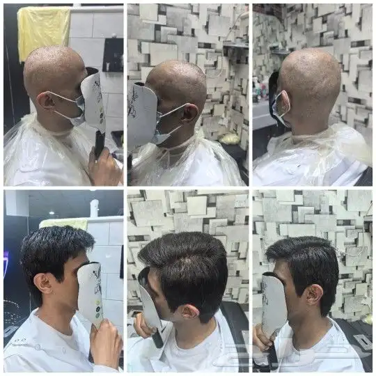تركيب شعر طبيعي راس كامله 0