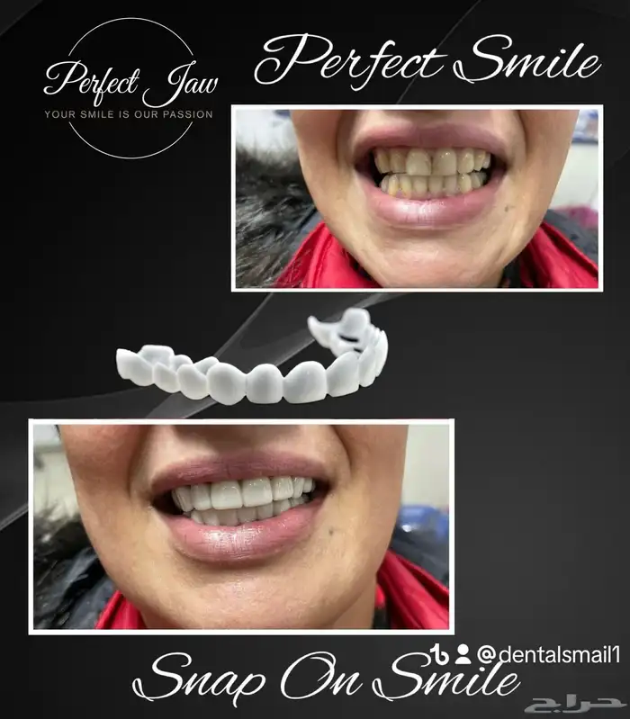 هوليود سمايل المتحرك 1