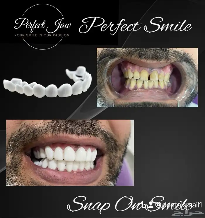 هوليود سمايل المتحرك 0