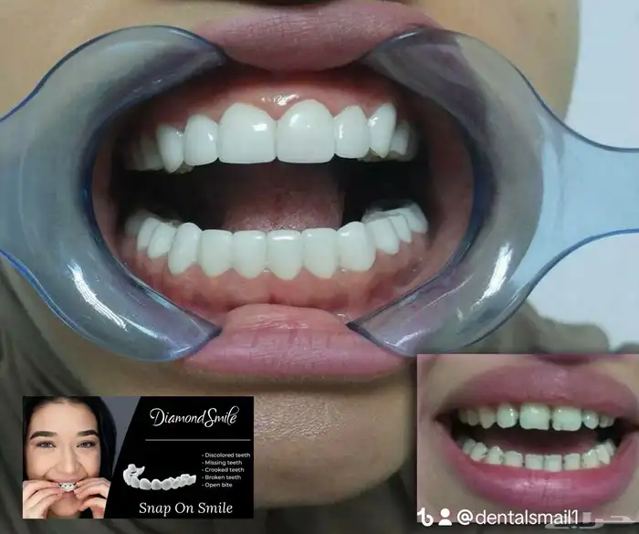 هوليود سمايل المتحرك 4