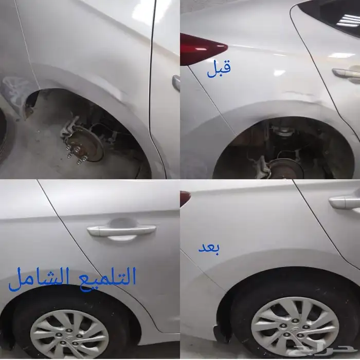 شفط وتعديل الصدمات على البارد 0