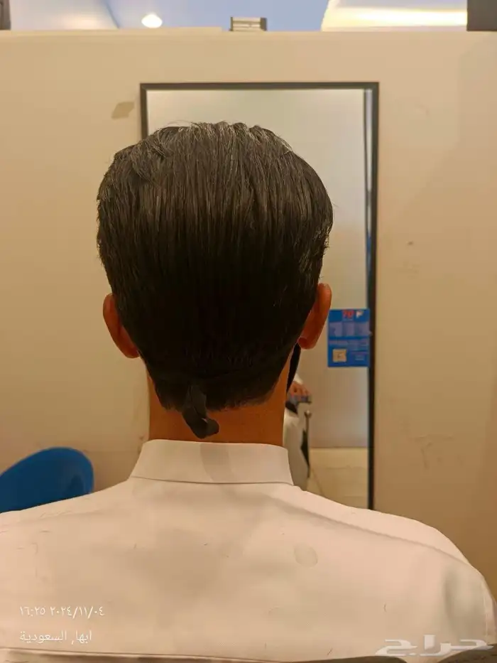 عرووض بيع وتركيب وصيانة شبكية شعر طبيعي يوجد تقصيد تمارا 10