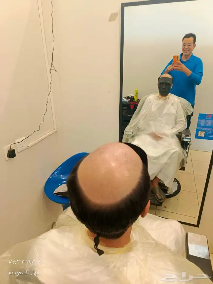 عرووض بيع وتركيب وصيانة شبكية شعر طبيعي يوجد تقصيد تمارا 7