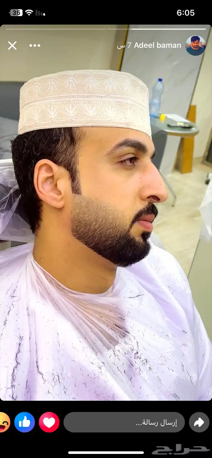 حلاق منزلي و في المستشفى حلاق سفري مغربي الجنسية 6