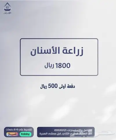 اقوى عروض زراعة الاسنان 0